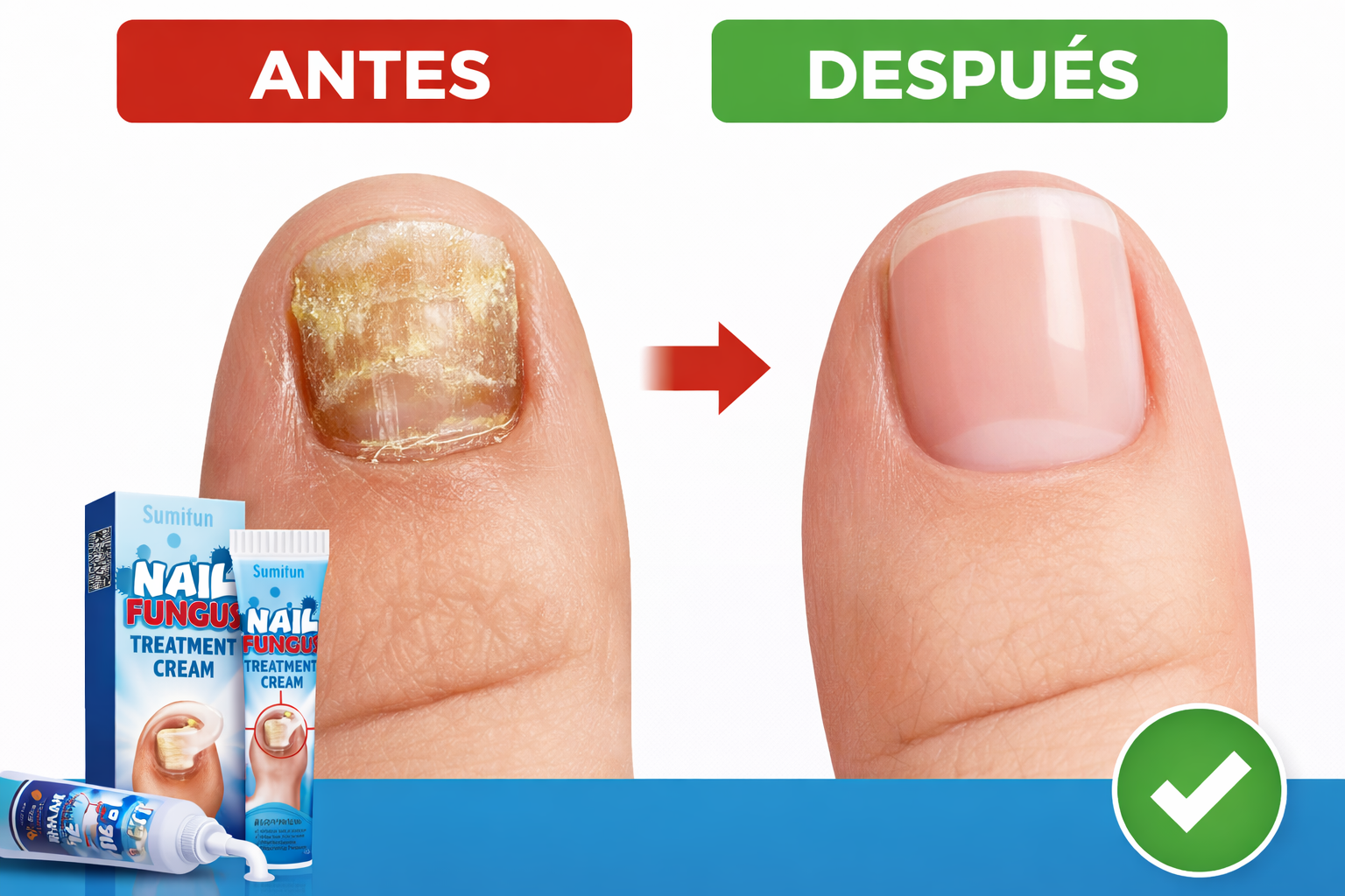FUNGICIDA PARA LAS UÑAS