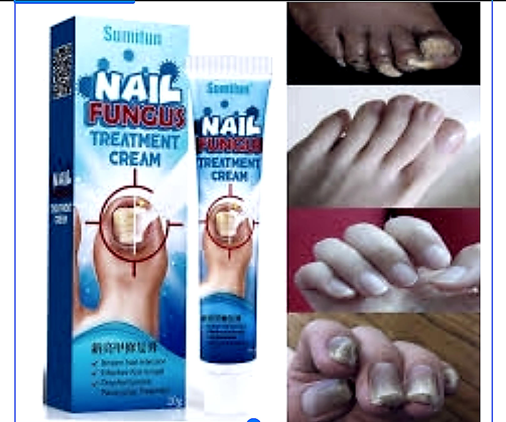 FUNGICIDA PARA LAS UÑAS